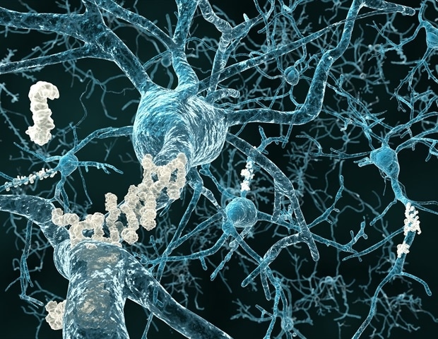 FINGERS-7B to eradicate Alzheimer's symptoms