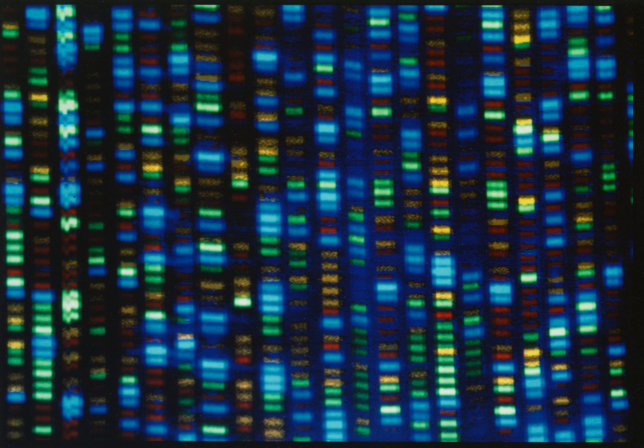 ChatGPT for genetics: Nvidia, Sheba join forces on AI engine for personalized medicine