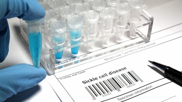 FDA approves gene therapies for sickle cell disease, a 'functional cure' for many