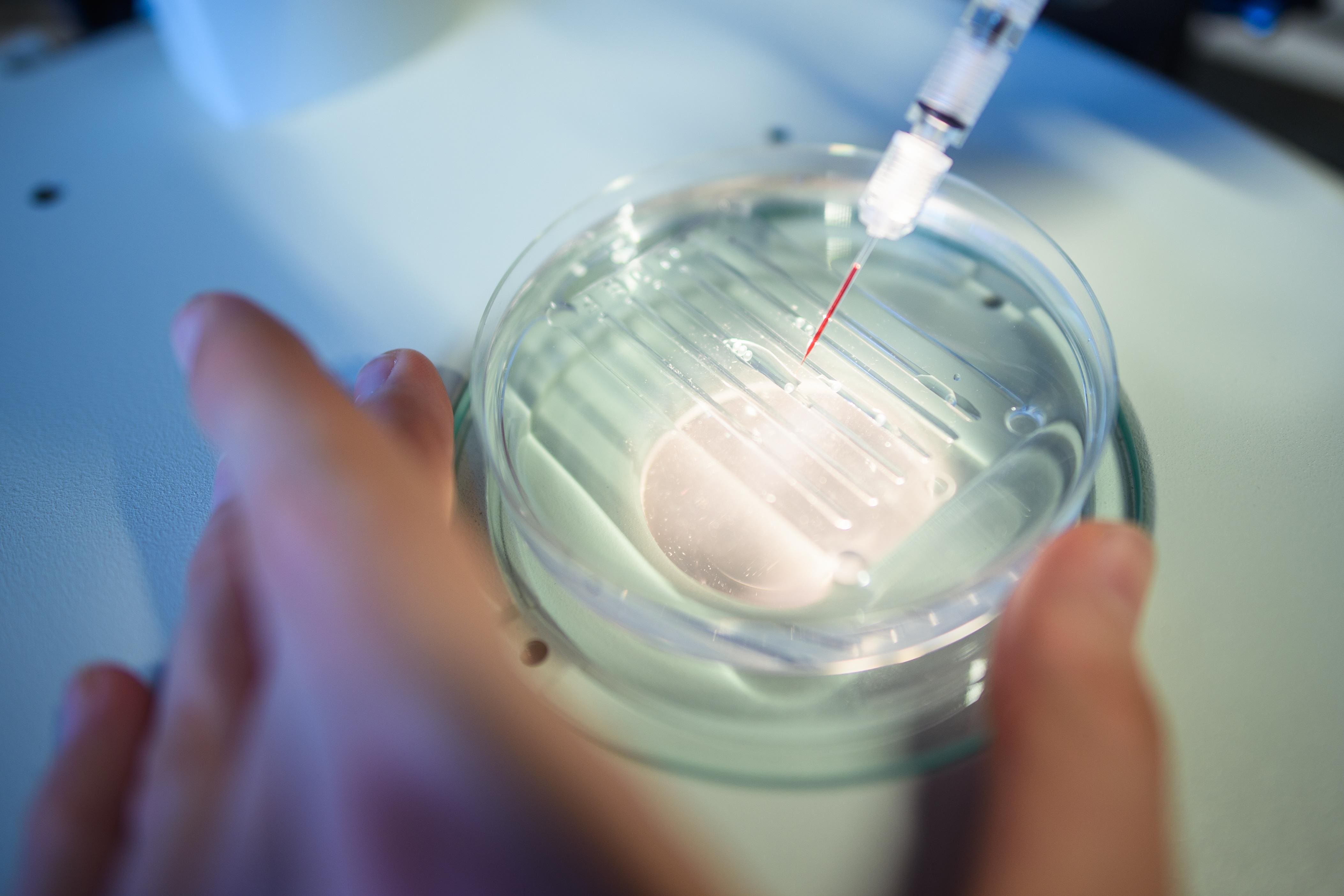 CRISPR Breakthrough Brings First In-Body Cure With Lonvo-Z